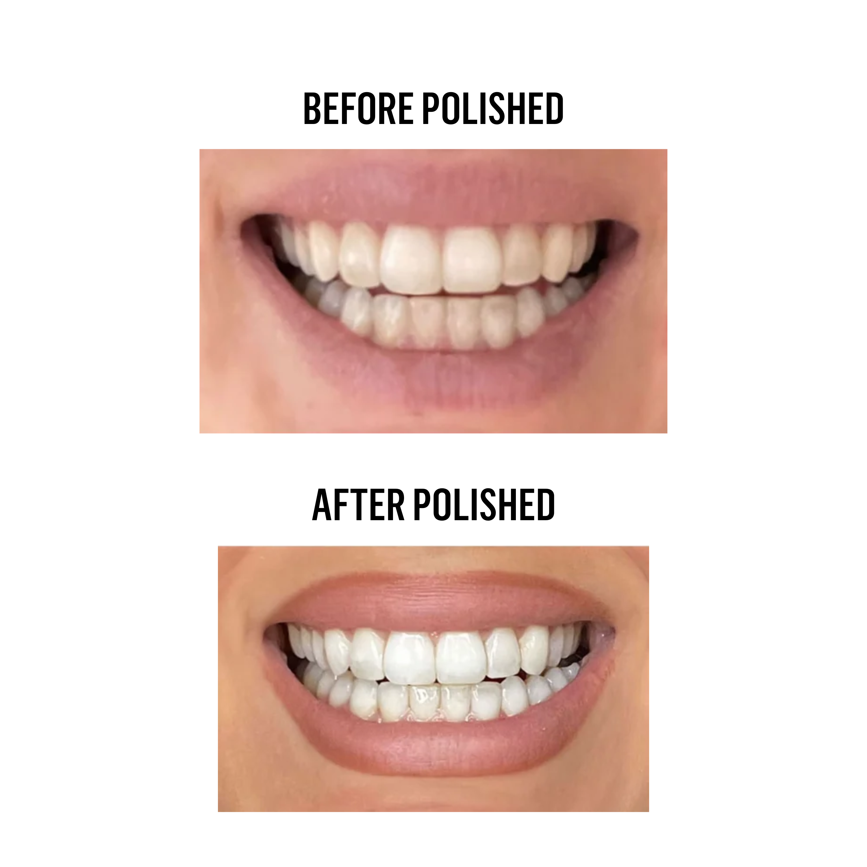 Teeth Whitening Powder