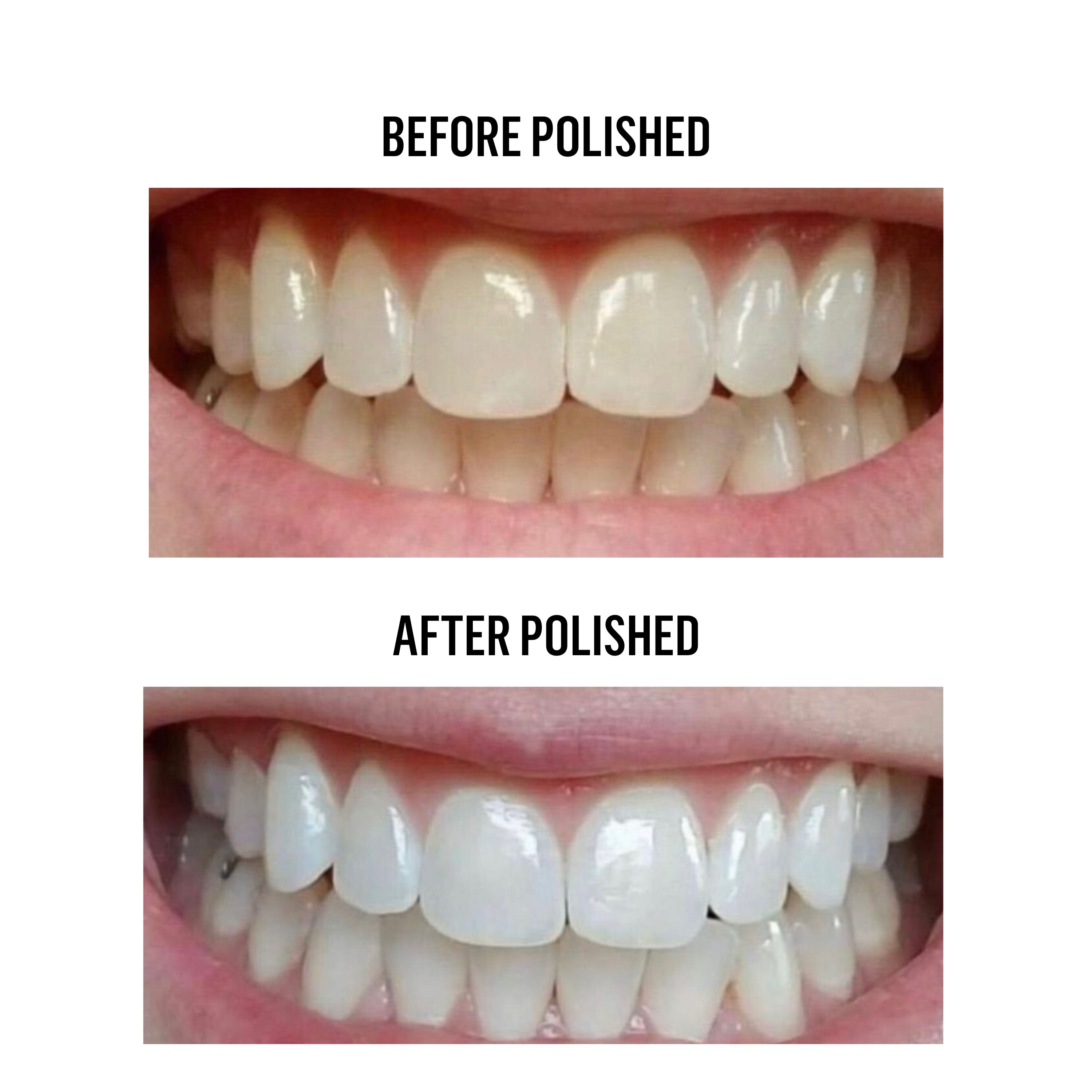 Teeth Whitening Powder