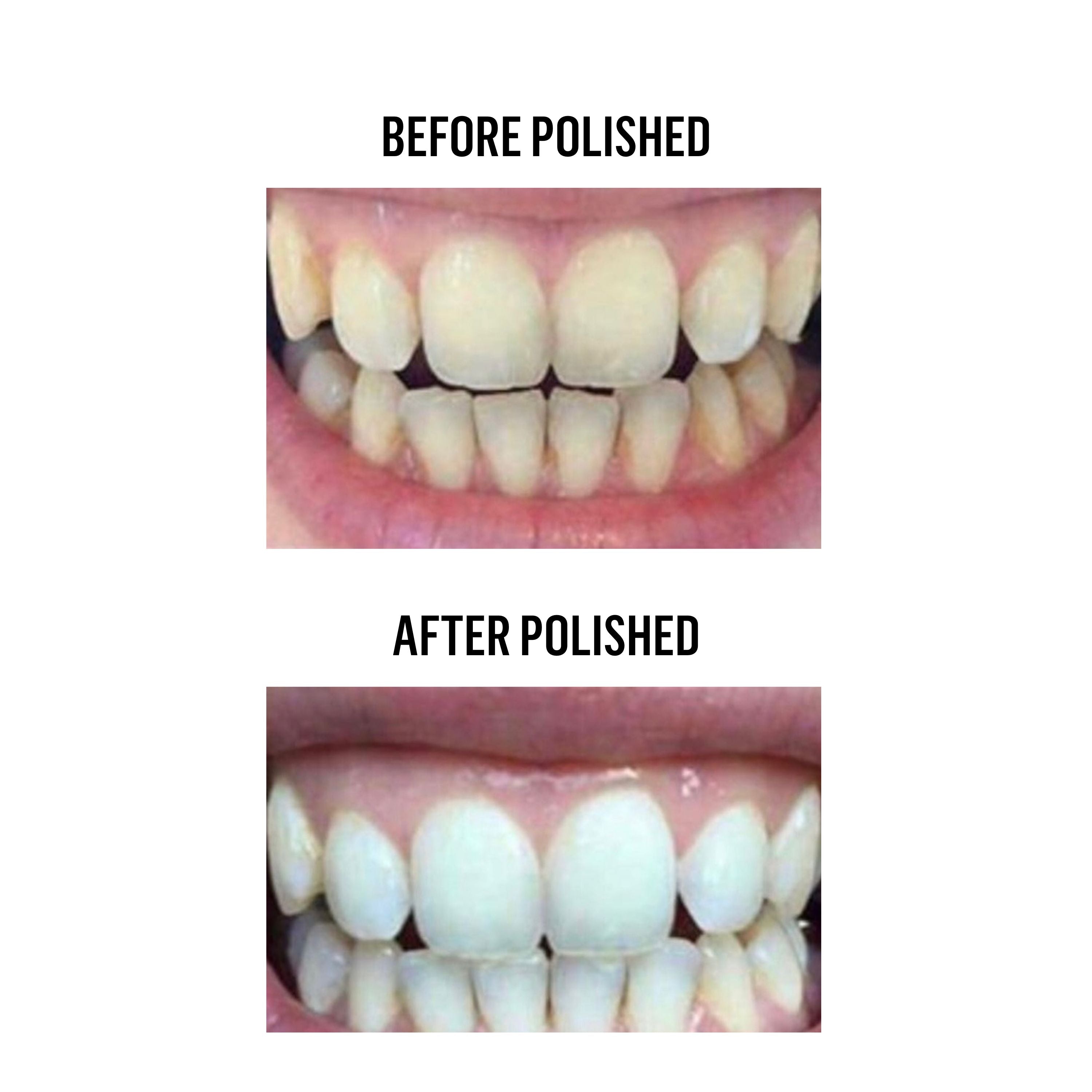 Teeth Whitening Powder