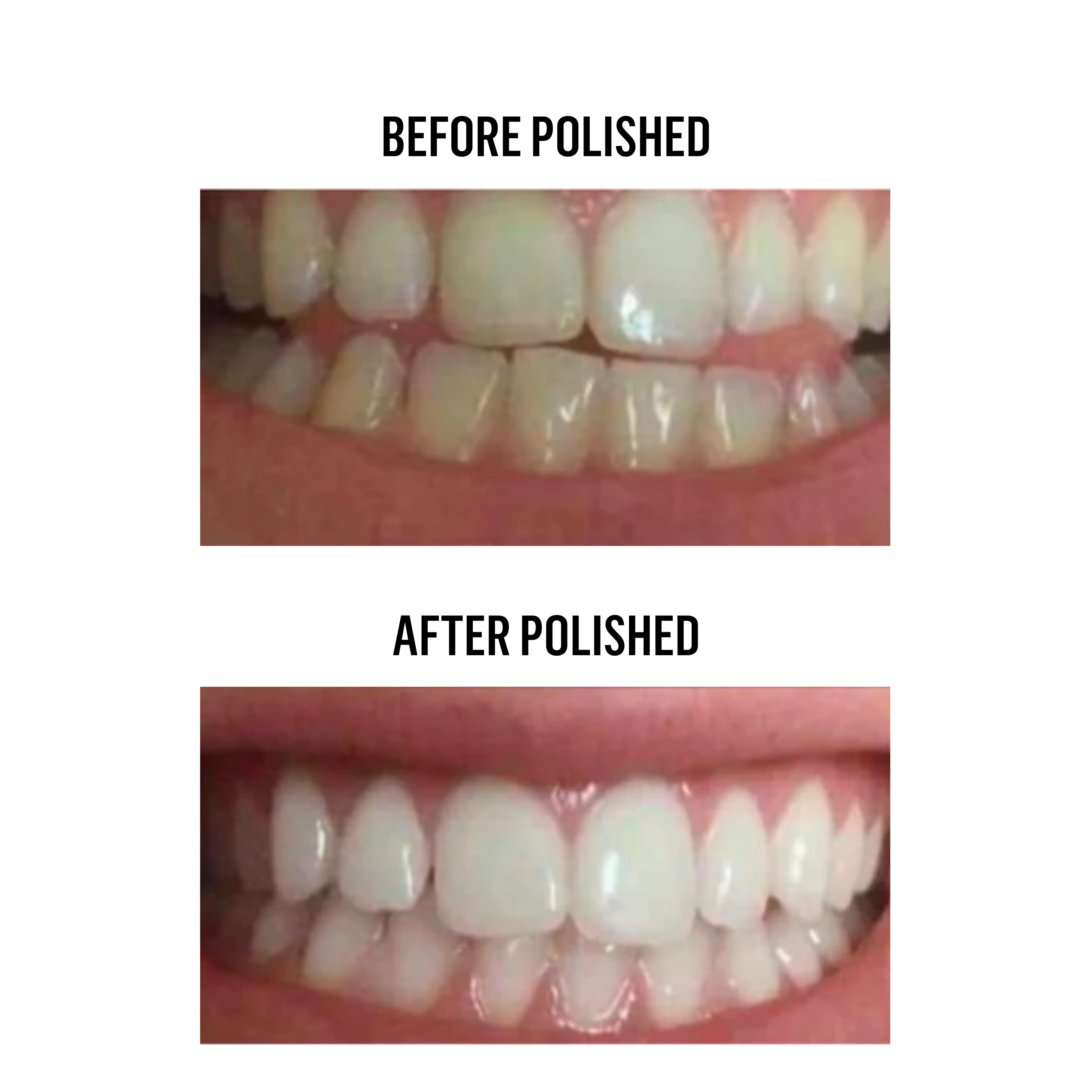 Teeth Whitening Powder