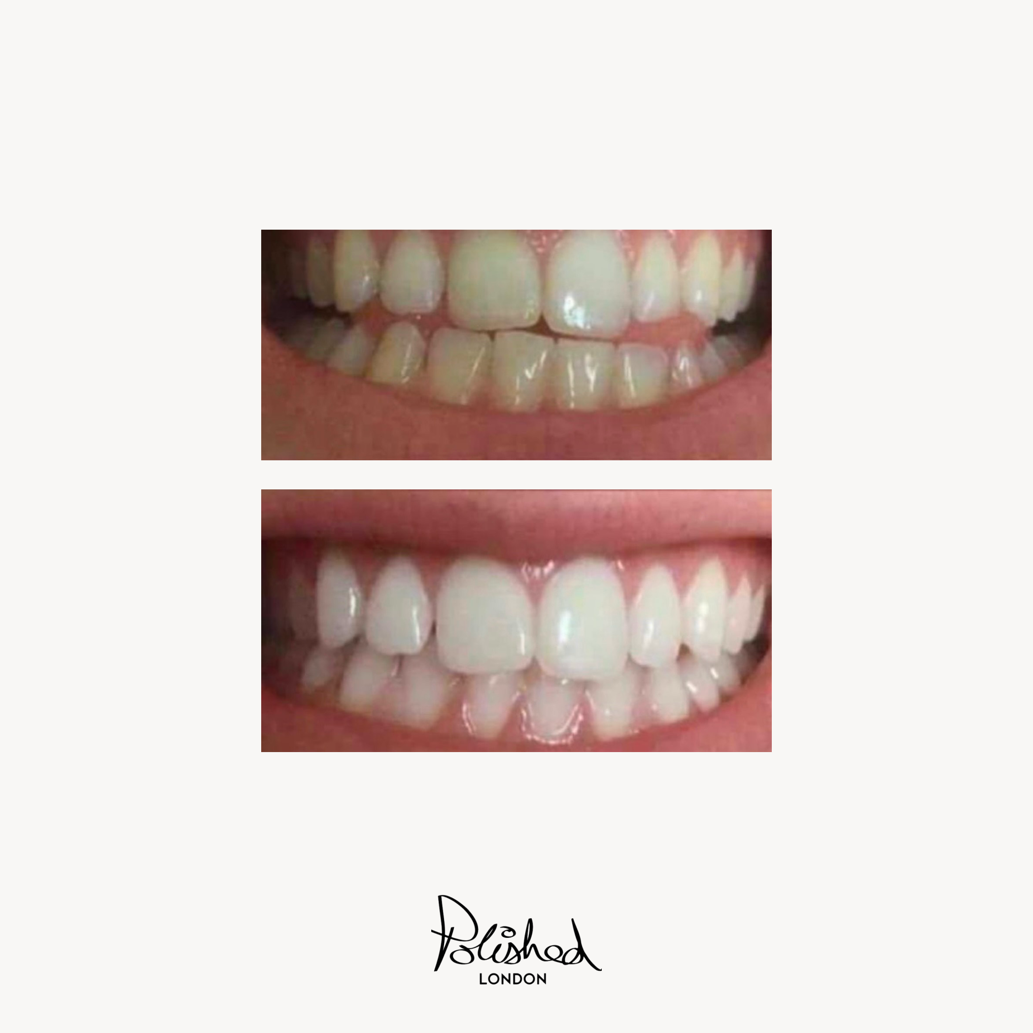 Teeth Whitening Powder