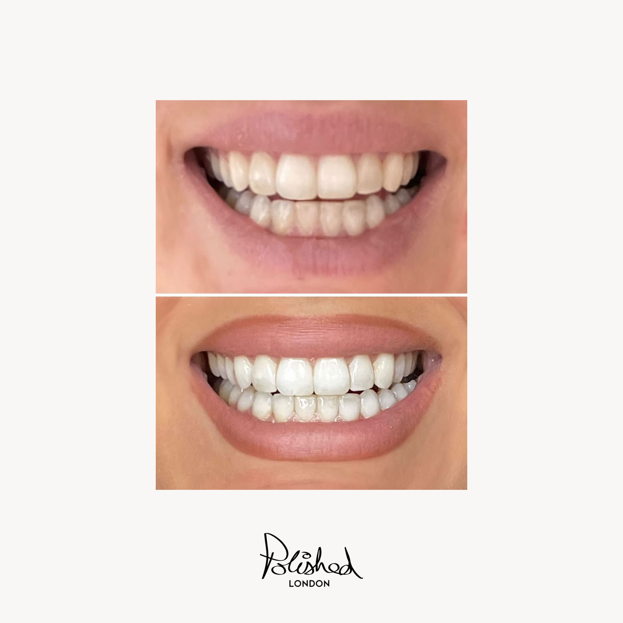 Teeth Whitening Powder